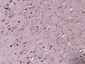 ACOX2 Polyclonal Antibody