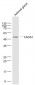 FADS1 Polyclonal Antibody