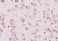 FADS1 Polyclonal Antibody