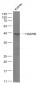 HADHB Polyclonal Antibody