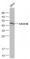 HADHB Polyclonal Antibody