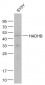 HADHB Polyclonal Antibody