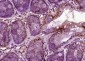 Matrin 3 Polyclonal Antibody