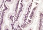 TRAK1 Polyclonal Antibody