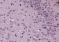 TRAK1 Polyclonal Antibody