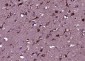 HEPACAM Polyclonal Antibody
