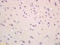 MAS1L Polyclonal Antibody