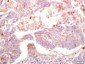 MAS1L Polyclonal Antibody