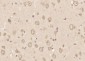 ABI2 Polyclonal Antibody