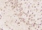 ABI2 Polyclonal Antibody