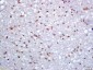 KDM5B Polyclonal Antibody
