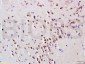 GNAT3 Polyclonal Antibody