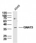 GNAT3 Polyclonal Antibody