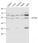 STK38 Polyclonal Antibody