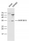 AKR1B10 Polyclonal Antibody