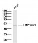 TMPRSS4 Polyclonal Antibody