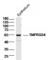 TMPRSS4 Polyclonal Antibody