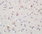 NTR3 Polyclonal Antibody