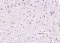 NTR3 Polyclonal Antibody