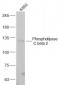 Phospholipase C beta 2 Polyclonal Antibody