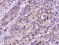 Phospholipase C beta 2 Polyclonal Antibody