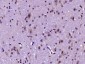 Phospholipase C beta 2 Polyclonal Antibody