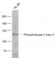 Phospholipase C beta 2 Polyclonal Antibody