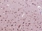 SCN8A/Nav1.6 Polyclonal Antibody