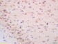 NALP2 Polyclonal Antibody