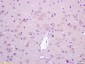 LGI1 Polyclonal Antibody