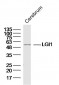 LGI1 Polyclonal Antibody