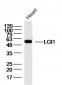 LGI1 Polyclonal Antibody