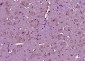 LGI1 Polyclonal Antibody