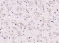 Coronin 3 Polyclonal Antibody