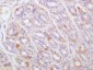 TPST1 Polyclonal Antibody