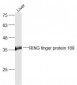 RING finger protein 189 Polyclonal Antibody