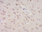 KDEL Polyclonal Antibody