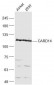 CARD14 Polyclonal Antibody