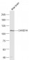 CARD14 Polyclonal Antibody