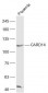 CARD14 Polyclonal Antibody