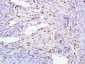 TIA1 Polyclonal Antibody