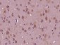 Tankyrase 2 Polyclonal Antibody