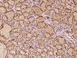 ZHX2 Polyclonal Antibody