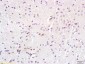 BS69 Polyclonal Antibody