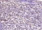 CAPD2 Polyclonal Antibody