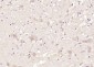 AMSH Polyclonal Antibody