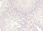 SKA3 Polyclonal Antibody