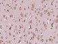 NEDD4 Polyclonal Antibody