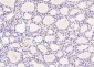 UBE2V1 Polyclonal Antibody