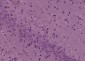 ENC1 Polyclonal Antibody